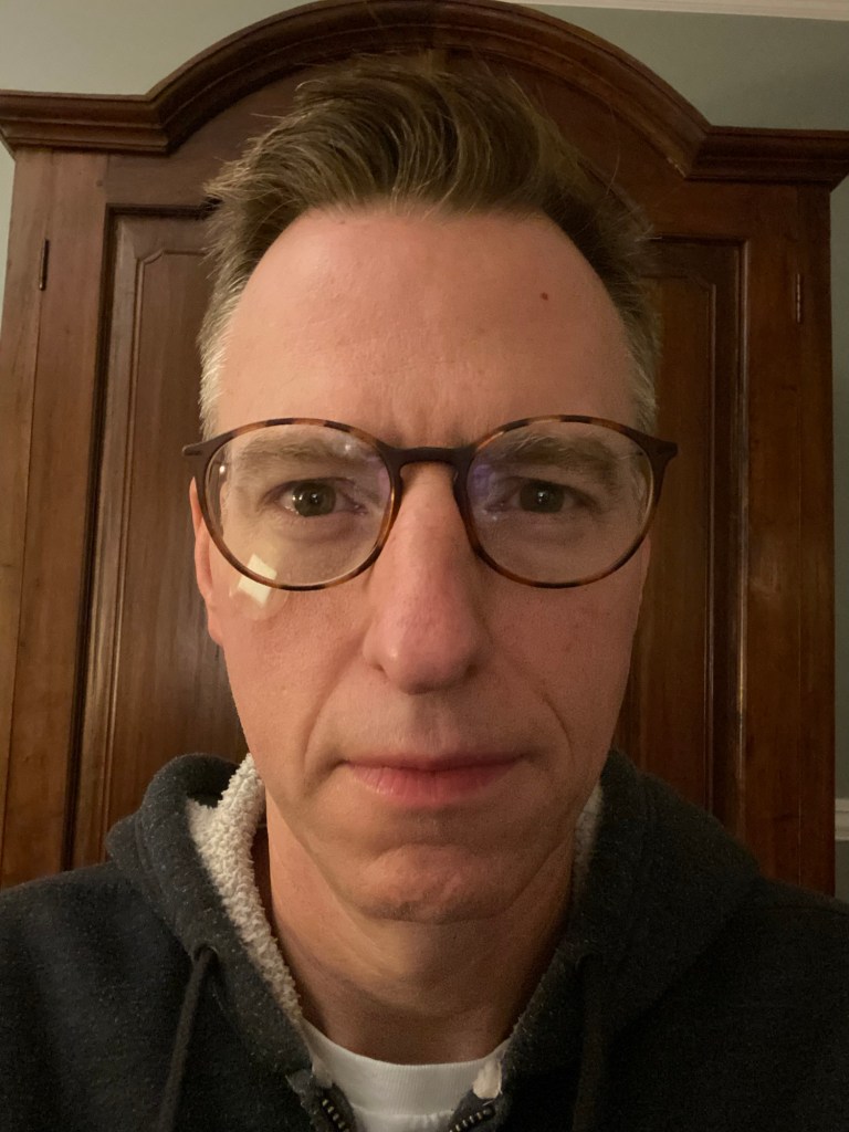 Selfie of middle aged man with glasses and a round bandage under his right eye